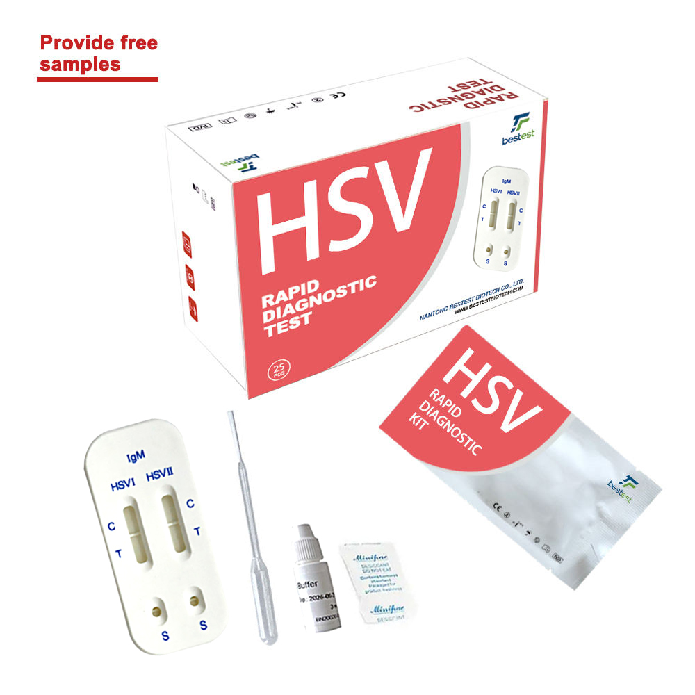 HSV-I and HSV-II IgM TEST